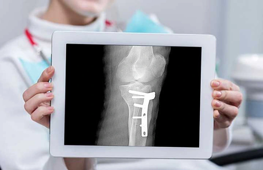 x-ray, digitalizer, holguin