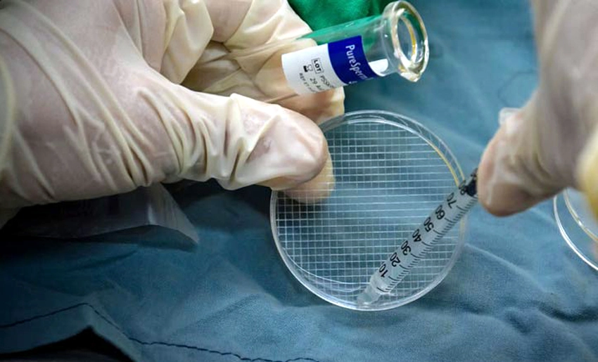 assisted, reproduction, holguin