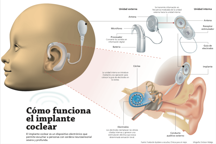Breaking the Silence of Hearing 1