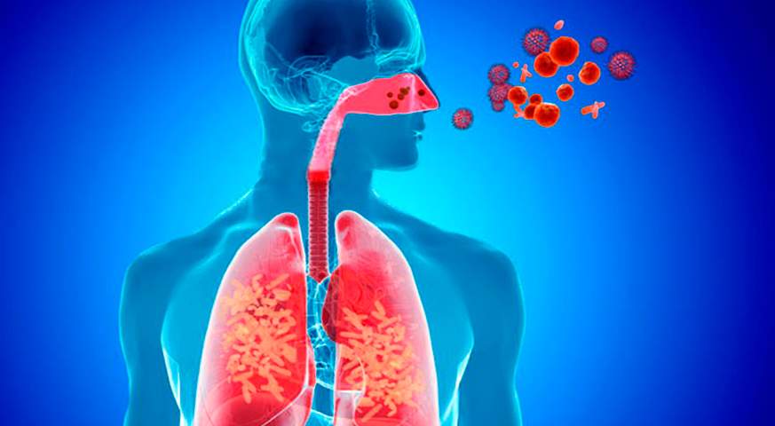 Holguín, salud, Infecciones Respiratorias Agudas