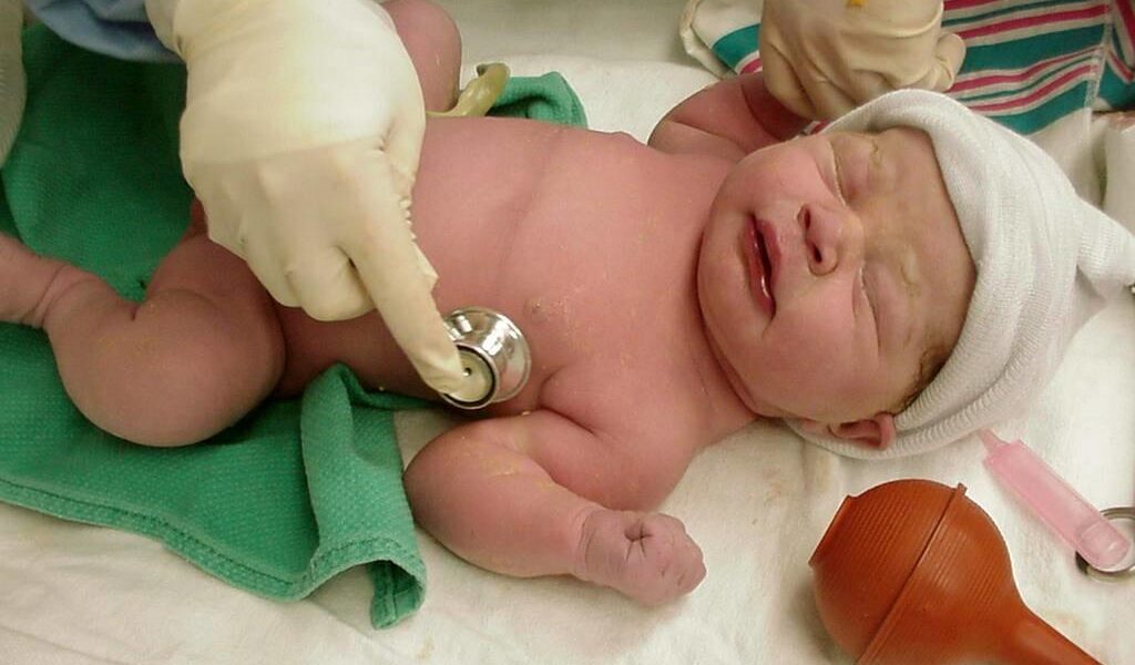 mortalidad infantil, Cuba, Neonatología, Salud Pública
