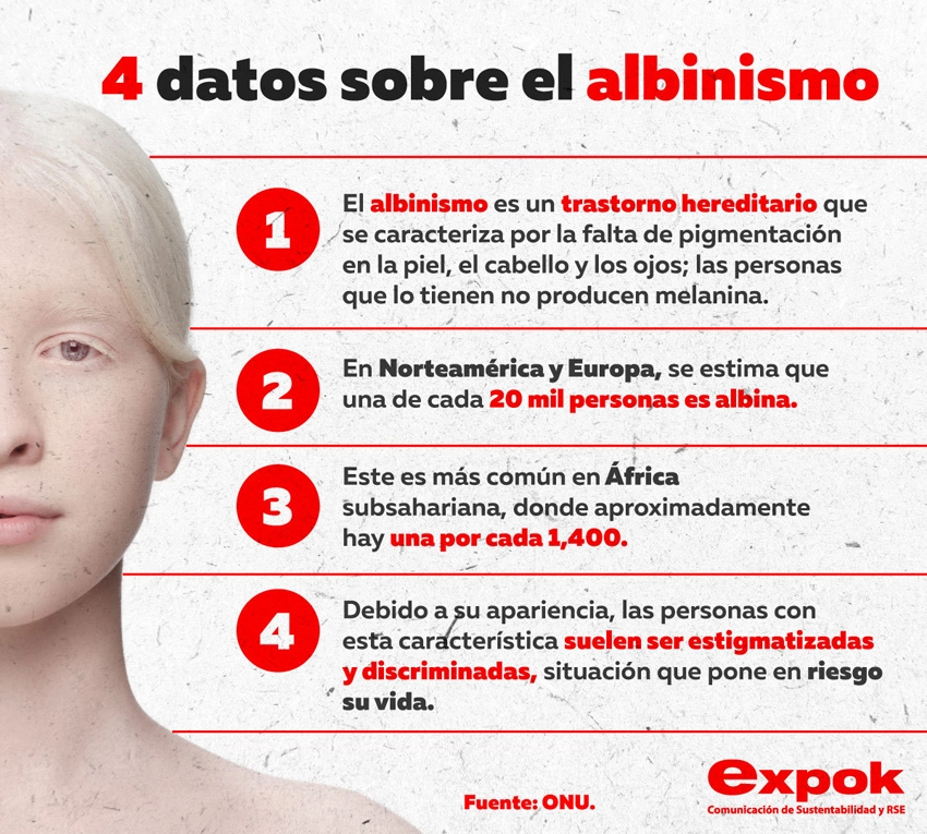 Infografía, Albinismo