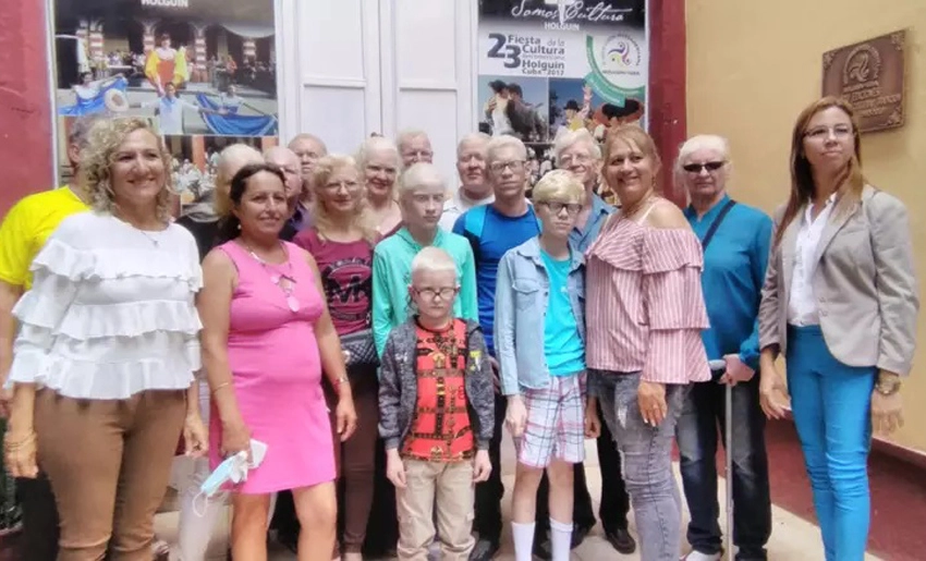 Albinos, Holguín, Cuba