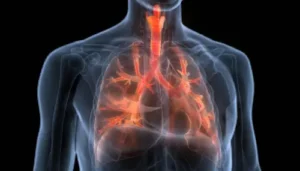 Enfermedad Pulmonar Obstructiva Crónica, día mundial 0