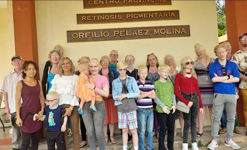 Personas con la condición de Albinismo en Holguín