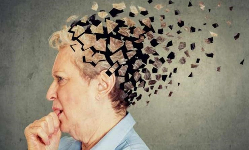 Alzheimer