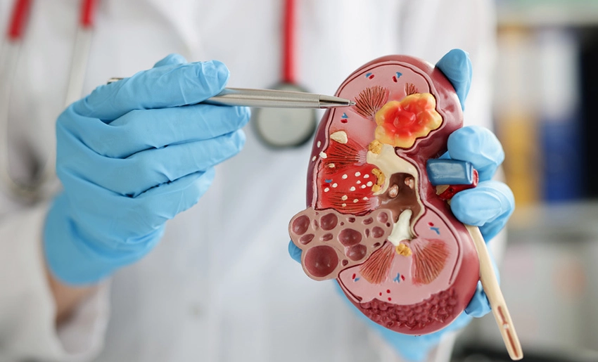 Nefrología, especialidad médica