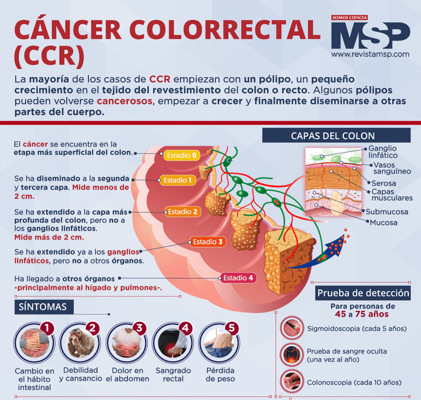 cáncer, colon, infografía, salud, día mundial
