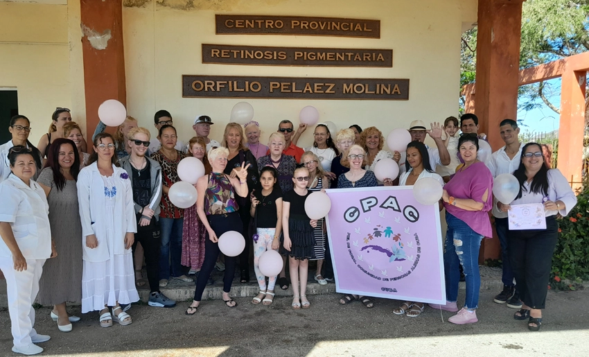 Comunidad de Albinismo, Holguín