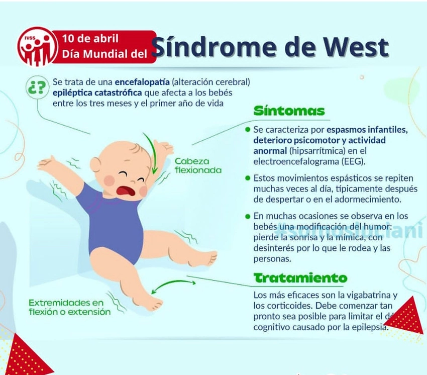 Síndrome de West, espasmos, salud, niños