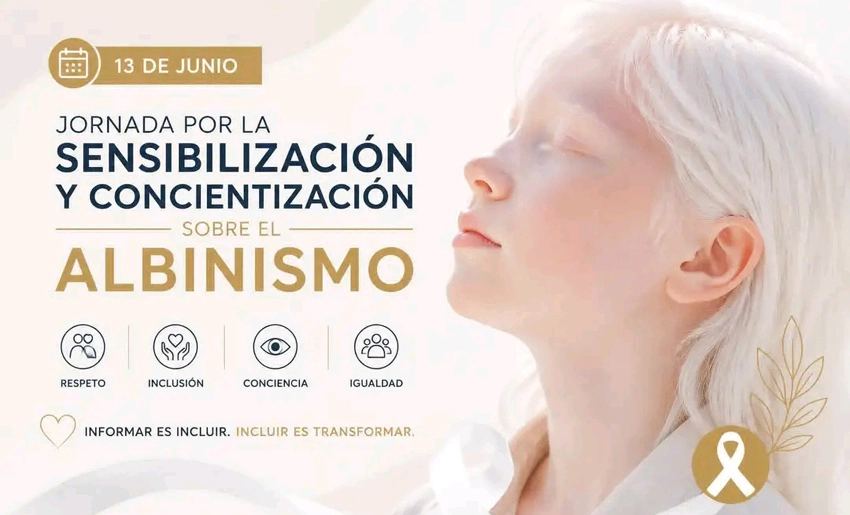 Albinismo